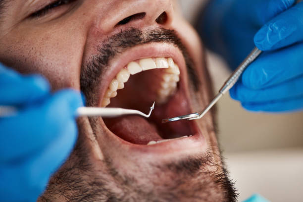 Best Emergency Dental Services for Seniors in Gordon, PA